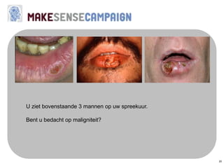 20
U ziet bovenstaande 3 mannen op uw spreekuur.
Bent u bedacht op maligniteit?
 