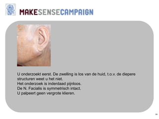 24
U onderzoekt eerst. De zwelling is los van de huid, t.o.v. de diepere
structuren weet u het niet.
Het onderzoek is inderdaad pijnloos.
De N. Facialis is symmetrisch intact.
U palpeert geen vergrote klieren.
 