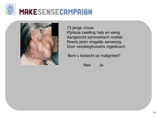 26
73 jarige vrouw.
Pijnloze zwelling hals en wang.
Aangezicht symmetrisch mobiel.
Reeds jaren mogelijk aanwezig.
Door verpleeghuisarts ingestuurd.
Bent u bedacht op maligniteit?
Nee Ja
 