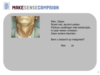 30
Man, 32jaar.
Rookt niet, alcohol zelden.
Pijnloze zwellingen hals beiderzijds,
In paar weken ontstaan.
Geen andere klachten.
Bent u bedacht op maligniteit?
Nee Ja
 