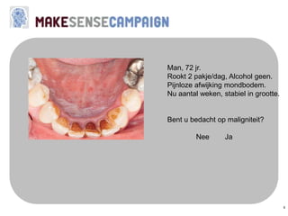 9
Man, 72 jr.
Rookt 2 pakje/dag, Alcohol geen.
Pijnloze afwijking mondbodem.
Nu aantal weken, stabiel in grootte.
Bent u bedacht op maligniteit?
Nee Ja
 