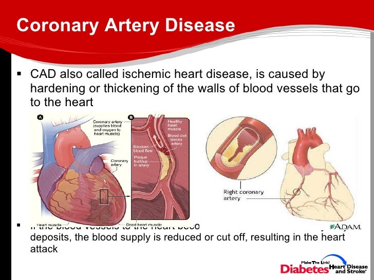 how does diabetes cause vascular disease