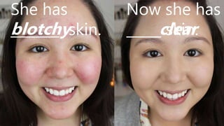 She has
_______ skin.
Now she has
_____ skin.blotchy clear
 