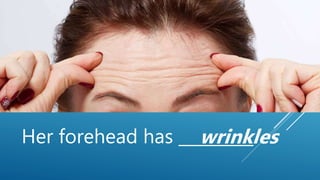 Her forehead has _________.wrinkles
 