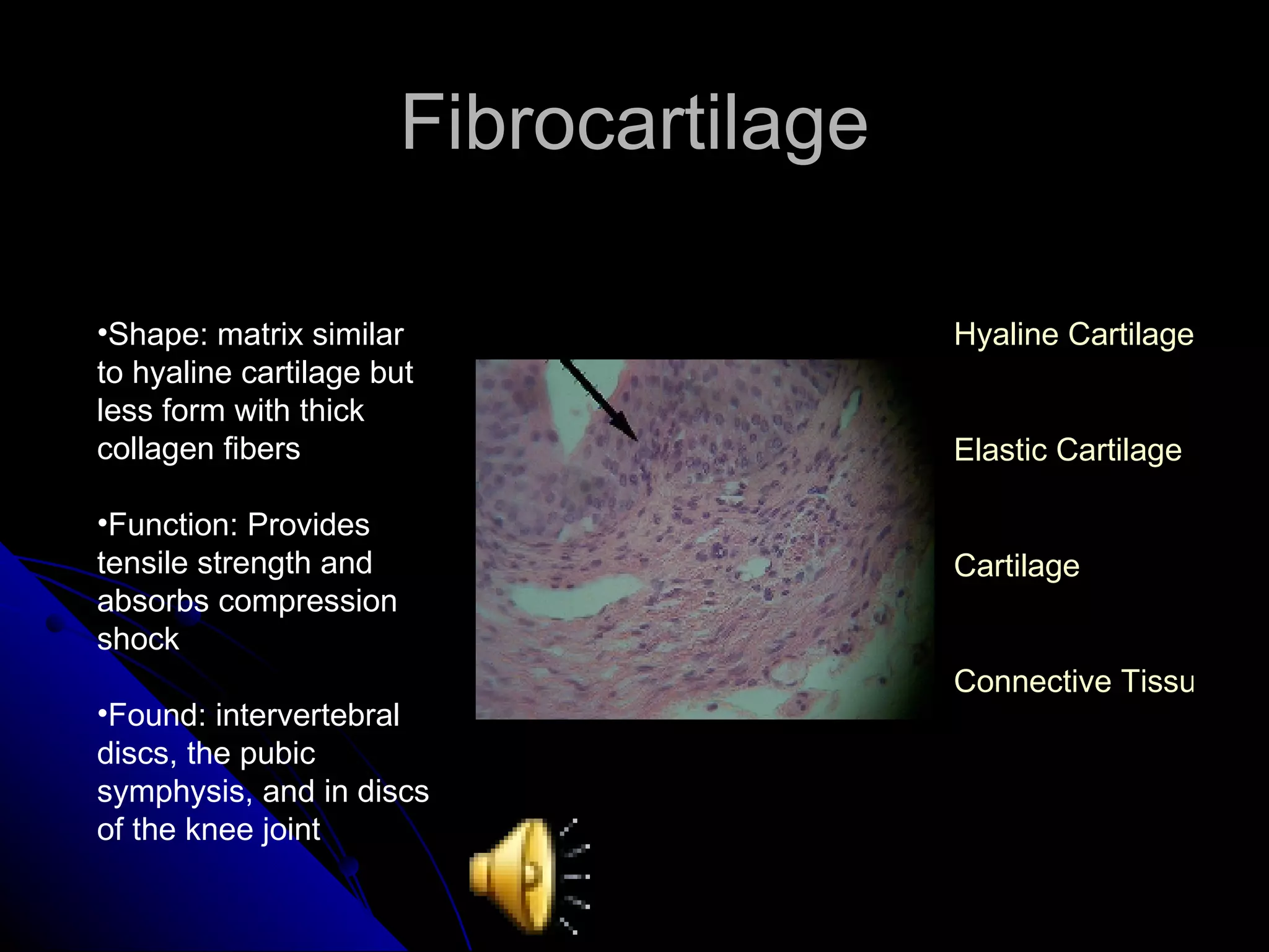 Fibrocartilage Shape: matrix similar to hyaline cartilage but less form with thick collagen fibers Function: Provides tensile strength and absorbs compression shock Found: intervertebral discs, the pubic symphysis, and in discs of the knee joint Hyaline Cartilage Elastic Cartilage Cartilage Connective Tissue 