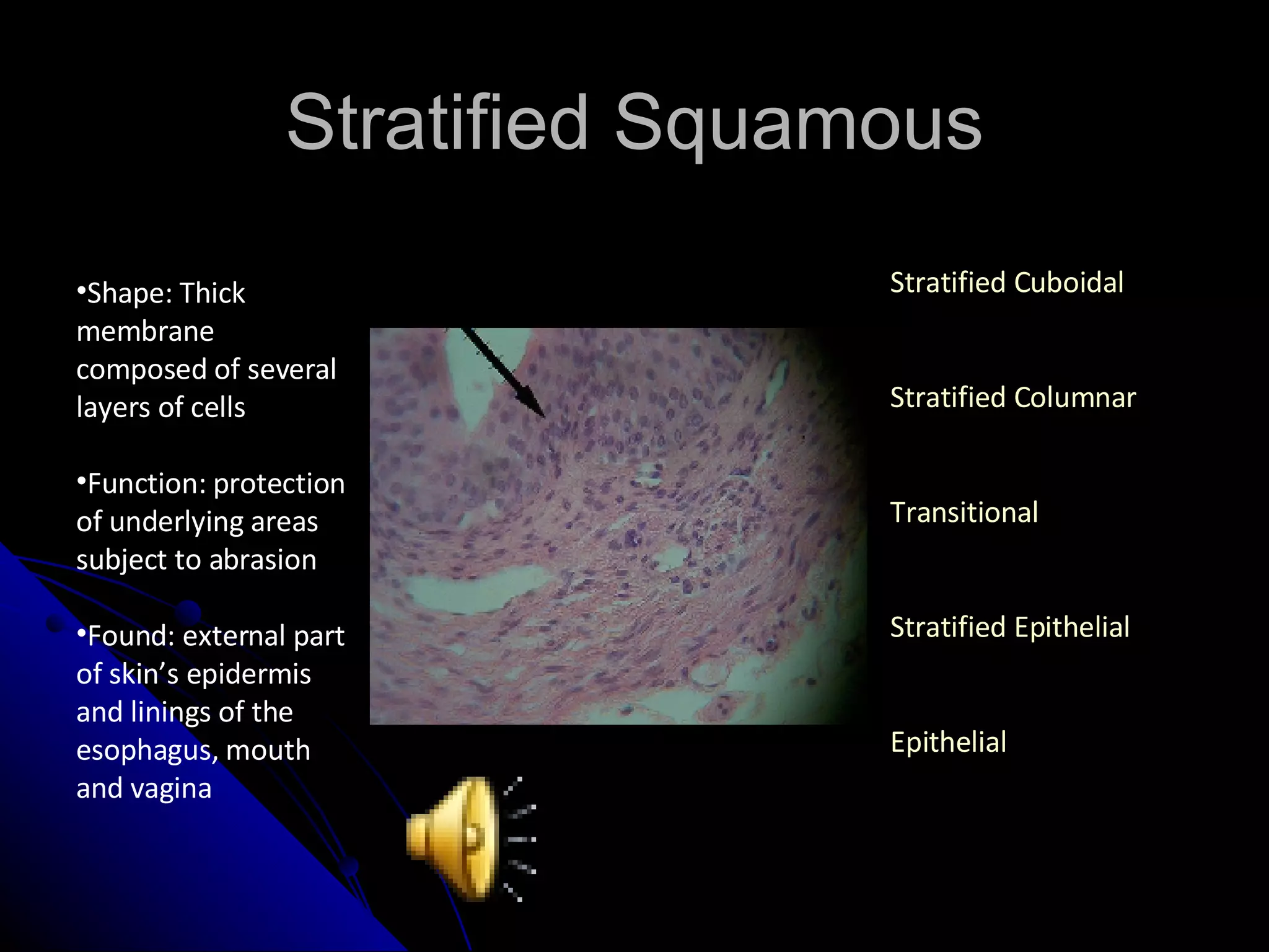 Stratified Squamous Shape: Thick membrane composed of several layers of cells Function: protection of underlying areas subject to abrasion Found: external part of skin’s epidermis and linings of the esophagus, mouth and vagina Stratified Cuboidal Stratified Columnar Transitional Stratified Epithelial Epithelial 