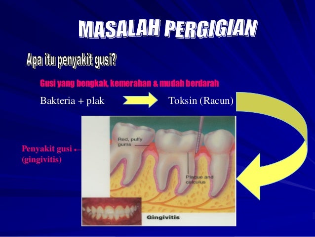 Maklumat asas kesihatan pergigian