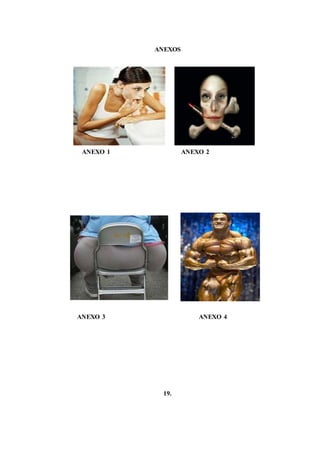 ANEXOS
ANEXO 1 ANEXO 2
ANEXO 3 ANEXO 4
19.
 
