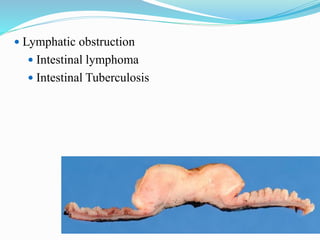  Lymphatic obstruction
 Intestinal lymphoma
 Intestinal Tuberculosis
 