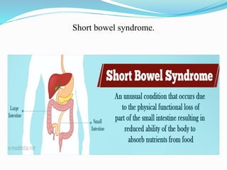 Short bowel syndrome.
 