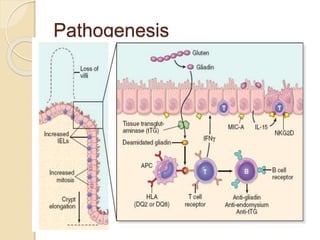 Pathogenesis
 