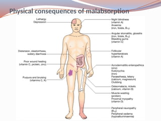 Physical consequences of malabsorption
 