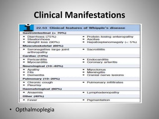 Clinical Manifestations
• Opthalmoplegia
 