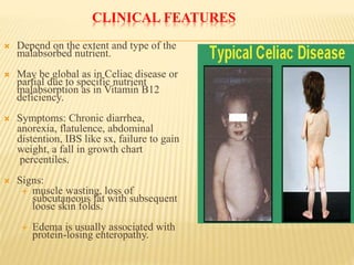 CLINICAL FEATURES
 Depend on the extent and type of the
malabsorbed nutrient.
 May be global as in Celiac disease or
partial due to specific nutrient
malabsorption as in Vitamin B12
deficiency.
 Symptoms: Chronic diarrhea,
anorexia, flatulence, abdominal
distention, IBS like sx, failure to gain
weight, a fall in growth chart
percentiles.
 Signs:
 muscle wasting, loss of
subcutaneous fat with subsequent
loose skin folds.
 Edema is usually associated with
protein-losing enteropathy.
 