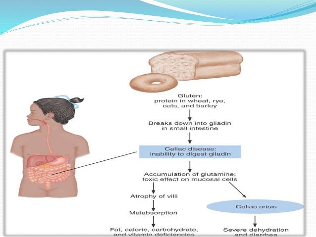 Malabsorption syndromes