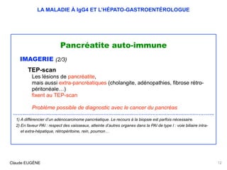LA MALADIE À IgG4 ET L’HÉPATO-GASTROENTÉROLOGUE
Pancréatite auto-immune
IMAGERIE (2/3)
TEP-scan
Les lésions de pancréatite...