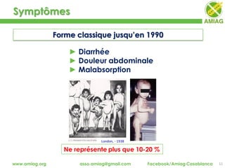 Symptômes
11www.amiag.org asso.amiag@gmail.com Facebook/Amiag Casablanca
Forme classique jusqu’en 1990
► Diarrhée
► Douleur abdominale
► Malabsorption
London, - 1938
Ne représente plus que 10-20 %
 