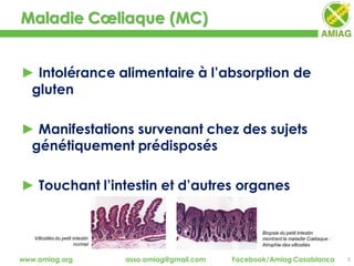 Maladie Cœliaque (MC)
5www.amiag.org asso.amiag@gmail.com Facebook/Amiag Casablanca
► Intolérance alimentaire à l’absorption de
gluten
► Manifestations survenant chez des sujets
génétiquement prédisposés
► Touchant l’intestin et d’autres organes
Biopsie du petit intestin
montrant la maladie Cœliaque :
Atrophie des villosités
Villosités du petit intestin
normal
 