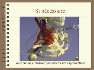 Si nécessaire Ponction trans-trachéale pour obtenir des expectorations 