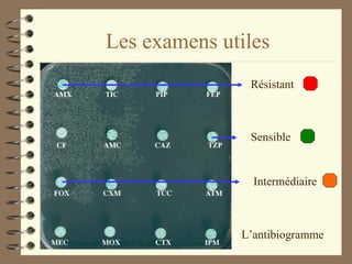 Les examens utiles L’antibiogramme Résistant Sensible Intermédiaire 
