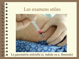 Les examens utiles La gazométrie artérielle (a. radiale ou a. fémorale) 