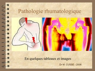 Pathologie rhumatologique En quelques tableaux et images Dr M. CUSSE - 2006 