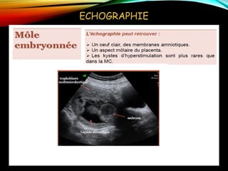 ECHOGRAPHIE
 