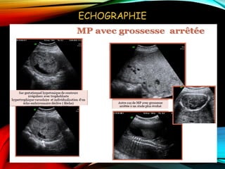 ECHOGRAPHIE
 