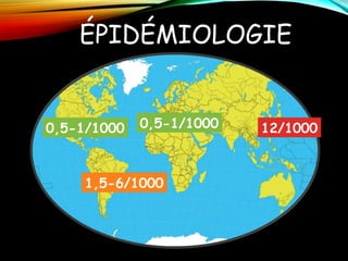 ÉPIDÉMIOLOGIE
12/10000,5-1/1000 0,5-1/1000
1,5-6/1000
 