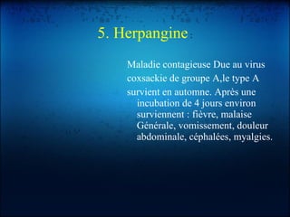 5. Herpangine  : Maladie contagieuse Due au virus coxsackie de groupe A,le type A survient en automne. Après une incubation de 4 jours environ surviennent : fièvre, malaise Générale, vomissement, douleur abdominale, céphalées, myalgies. 