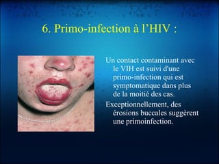 6. Primo-infection à l’HIV : Un contact contaminant avec le VIH est suivi d'une primo-infection qui est symptomatique dans plus de la moitié des cas. Exceptionnellement, des érosions buccales suggèrent une primoinfection. 