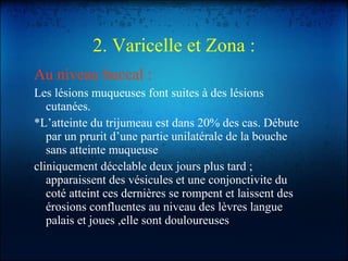 2. Varicelle et Zona   : Au niveau buccal : Les lésions muqueuses font suites à des lésions cutanées. *L’atteinte du trijumeau est dans 20% des cas. Débute par un prurit d’une partie unilatérale de la bouche sans atteinte muqueuse cliniquement décelable deux jours plus tard ; apparaissent des vésicules et une conjonctivite du coté atteint ces dernières se rompent et laissent des érosions confluentes au niveau des lèvres langue palais et joues ,elle sont douloureuses  
