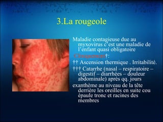 3.La rougeole Maladie contagieuse due au myxovirus c’est une maladie de l’enfant quasi obligatoire Cliniquement  :     Ascension thermique .   Irritabilité.      Catarrhe (nasal – respiratoire – digestif – diarrhées – douleur abdominale) après qq. jours exanthème au niveau de la tête derrière les oreilles en suite cou épaule tronc et racines des membres  