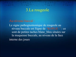 3.La rougeole   Au niveau buccal : Le signe pathognomonique de rougeole au niveau buccale est Signe de  “KOPLIC ”  : ce sont de petites taches blanc_bleu situées sur la muqueuse buccale, au niveau de la face interne des joues 