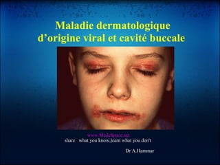 www.MedeSpace.net share  what you know,learn what you don't  Dr A.Hammar  Maladie dermatologique d’origine viral et cavité buccale  