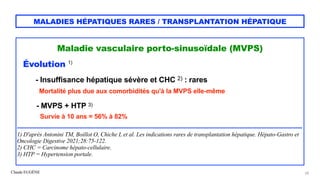 Claude EUGÈNE
MALADIES HÉPATIQUES RARES / TRANSPLANTATION HÉPATIQUE
Maladie vasculaire porto-sinusoïdale (MVPS)


Évolutio...