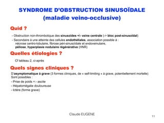 SYNDROME D’OBSTRUCTION SINUSOÏDALE
(maladie veino-occlusive)
Quid ? 
- Obstruction non-thrombotique des sinusoïdes +/- veine centrale (-> bloc post-sinusoïdal) 
- Secondaire à une atteinte des cellules endothéliales, association possible à :  
nécrose centro-lobulaire, fibrose péri-sinusoïdale et endoveinulaire,  
péliose, hyperplasie nodulaire régénérative (HNR)
Quelles étiologies ? 
Cf tableau 2, ci-après
Quels signes cliniques ?
D’asymptomatique à grave (3 formes cliniques, de « self-limiting » à grave, potentiellement mortelle) 
Sont possibles :
- Prise de poids +:- ascite 
- Hépatomégalie douloureuse 
- Ictère (forme grave)
11
Claude EUGENE
 