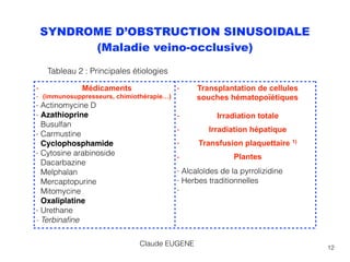 12
SYNDROME D’OBSTRUCTION SINUSOIDALE
(Maladie veino-occlusive)
- Médicaments
- (immunosuppresseurs, chimiothérapie…)
- Actinomycine D
- Azathioprine 
Busulfan
- Carmustine 
Cyclophosphamide
- Cytosine arabinoside 
Dacarbazine 
Melphalan 
Mercaptopurine 
Mitomycine 
Oxaliplatine
- Urethane
- Terbinaﬁne
- Transplantation de cellules
souches hématopoïétiques 
- Irradiation totale
- Irradiation hépatique
- Transfusion plaquettaire 1)
- Plantes
- Alcaloïdes de la pyrrolizidine
- Herbes traditionnelles
-
Claude EUGENE
Tableau 2 : Principales étiologies
 