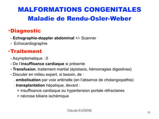 MALFORMATIONS CONGENITALES
Maladie de Rendu-Osler-Weber
•Diagnostic 
- Echographie-doppler abdominal +/- Scanner 
- Echocardiographie
•Traitement 
- Asymptomatique : 0 
- De l’insuffisance cardiaque si présente 
- Transfusion, traitement martial (épistaxis, hémorragies digestives) 
- Discuter en milieu expert, si besoin, de : 
. embolisation par voie artérielle (en l’absence de cholangiopathie) 
. transplantation hépatique, devant : 
> insuffisance cardiaque ou hypertension portale réfractaires 
> nécrose biliaire ischémique
15
Claude EUGENE
 
