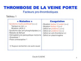3
THROMBOSE DE LA VEINE PORTE
Facteurs pro-thrombotiques
« Maladies »
- Syndrome myélo-prolifératif (+++) 
Typique ou non ++ 
Mutation JACK 2
- Syndrome des anti-phospholipides (+)
- Maladie de Behçet
- Hémoglobinurie paroxystique nocturne
- Grossesse 1)
- Pilule contraceptive 1) 
 
 
1) Toujours rechercher une autre cause
Coagulation
- Mutation facteur V Leiden (++)
- Mutation facteur II (++)
- Déﬁcit en protéine C (++)
- Déﬁcit en protéine S (++)
- Déﬁcit en anti-thrombine (+)
- Déﬁcit en plasminogène
Claude EUGENE
Tableau 1
 