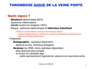 THROMBOSE AIGUE DE LA VEINE PORTE
• Quels signes ?
- Douleurs abdominales (90%) 
- Syndrome inflammatoire 
- Ascite (surtout en imagerie / 50%) 
- Risque : extension splanchnique et infarctus intestinal 
Penser à une thrombose veineuse mésentérique devant :  
` douleurs abdominales ou lombaires, soudaines et violentes contrastant avec , 
` absence de signes péritonéaux 
- Diagnostic
Echographie : opérateur-dépendant…
absence de flux, thrombus échogène 
Scanner (ou IRM), moins opérateur-dépendant,  
bilan lésionnel plus complet 
en faveur du caractère aigu:  
caillot spontanément hyperdense, absence de cavernome porte
4
Claude EUGENE
 