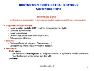 OBSTUCTION PORTE EXTRA HEPATIQUE
Cavernome Porte
Thrombose porte : 
si absence re-canalisation -> cavernome port (chevelu de collatérales porto-portes)
• Diagnostic évoqué devant : 
- Hypertension portale (HTP), varices oesophagiennes (VO) 
- Douleurs abdominales 
- Hyper-splénisme 
- Cholestase, anomalies biliaires (Bili-IRM) 
- Echo-doppler, Scanner
• Eliminer 
- Cirrhose (Tests hépatiques / Elastométrie …) 
- Veinopathie portale obstructive (cf ci-dessous)
• Traitement 
- De la cause, 
par exemple : anticoagulant au long cours lors d’un syndrome mylelo-prolifératif, 
(éventuellement après traitement des VO) 
- De l’HTP
6
Claude EUGENE
 