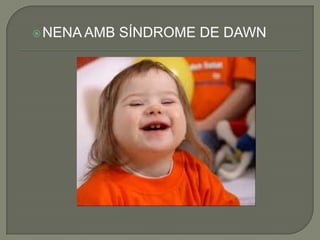  NENA AMB   SÍNDROME DE DAWN
 