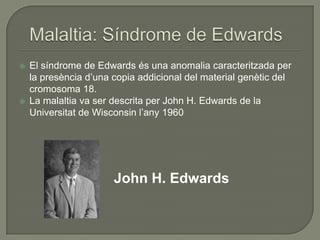    El síndrome de Edwards és una anomalia caracteritzada per
    la presència d’una copia addicional del material genètic del
    cromosoma 18.
   La malaltia va ser descrita per John H. Edwards de la
    Universitat de Wisconsin l’any 1960




                       John H. Edwards
 