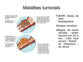 Malalties tumorals ,[object Object],[object Object],[object Object]