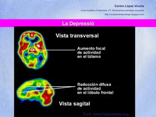 Centre López Vicuña Cures Auxiliars d´Infermeria. C7- Recolzament psicològic al pacient http://recolzamentpsicologic.blogspot.com La Depressió Font: www.hipocampo.org 