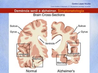 Centre López Vicuña Cures Auxiliars d´Infermeria. C7- Recolzament psicològic al pacient http://recolzamentpsicologic.blogspot.com Demència senil o alzheimer.  Simptomatologia 