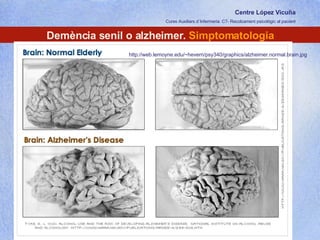 Centre López Vicuña Cures Auxiliars d´Infermeria. C7- Recolzament psicològic al pacient http://recolzamentpsicologic.blogspot.com Demència senil o alzheimer.  Simptomatologia http://web.lemoyne.edu/~hevern/psy340/graphics/alzheimer.normal.brain.jpg 