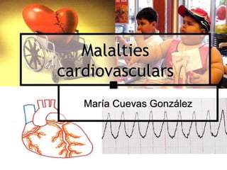 Malalties cardiovasculars María Cuevas González 