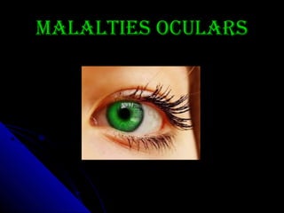 Malalties oculars

 